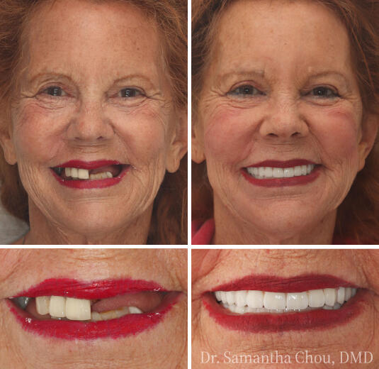 Dr Samantha Chou in Glenview Illinois