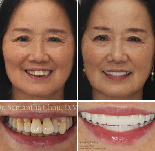 Dr Samantha Chou in Glenview Illinois