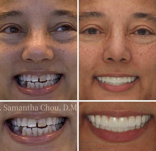 Dr Samantha Chou in Glenview Illinois