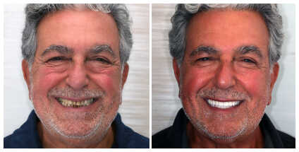 Dr Samantha Chou in Glenview Illinois