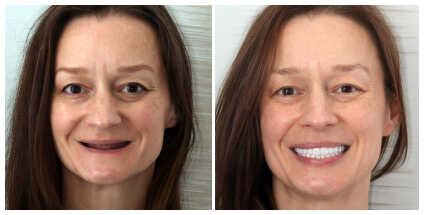 Dr Samantha Chou in Glenview Illinois