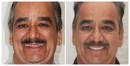 Dr Samantha Chou in Glenview Illinois